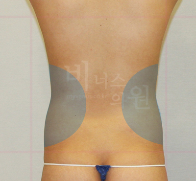 abdomen_waist 1.jpg