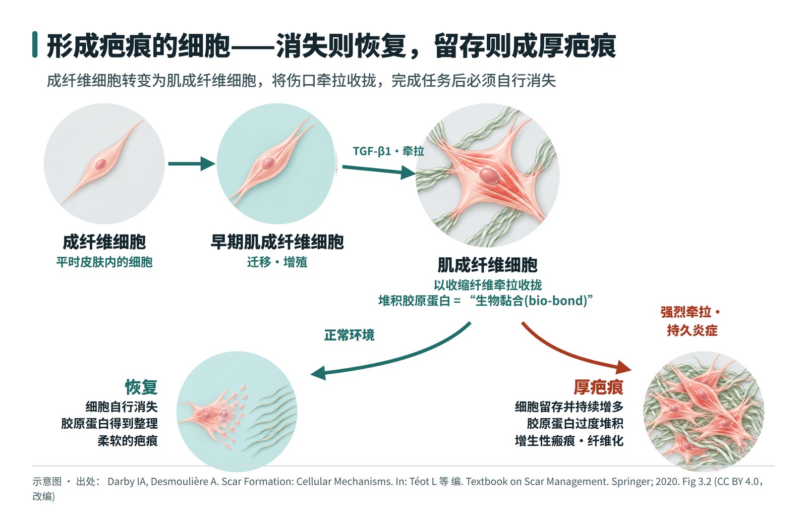 成纤维细胞转变为肌成纤维细胞后，消失则恢复、留存则形成厚疤痕的过程