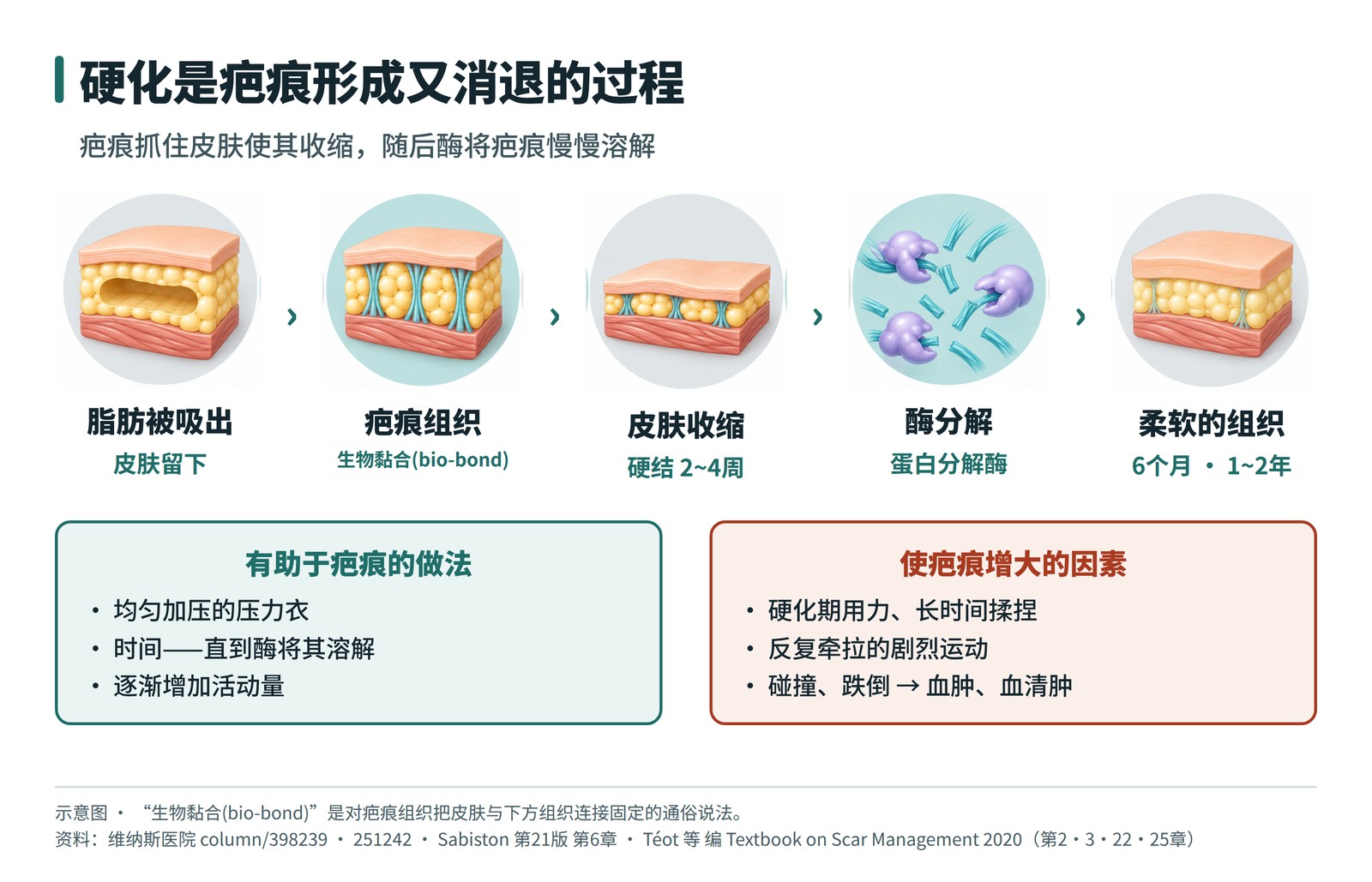 硬化是疤痕形成又消退的过程——生物黏合(bio-bond)、蛋白分解酶与使疤痕增大的物理刺激