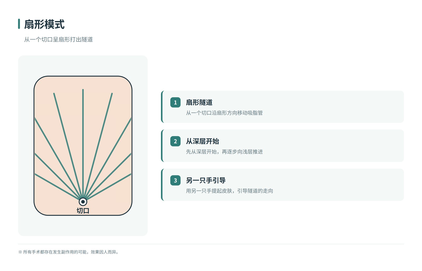 扇形模式示意图——从一个切口呈扇形展开的隧道