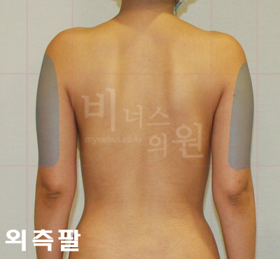 arm_straight 1.jpg