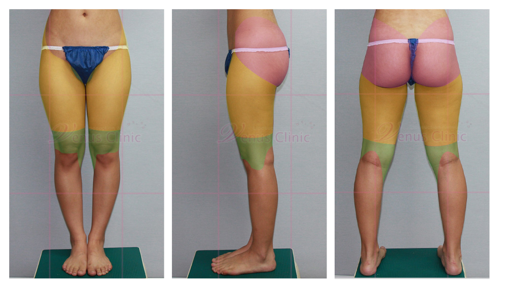 design_thighs1.jpg