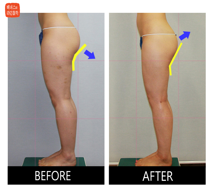 buttocks1.jpg